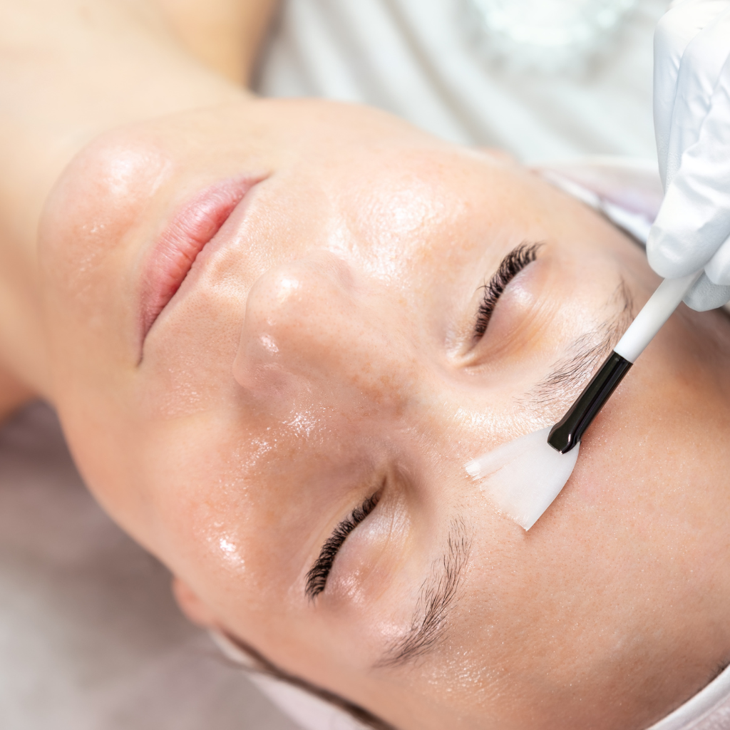 Chemical Peels